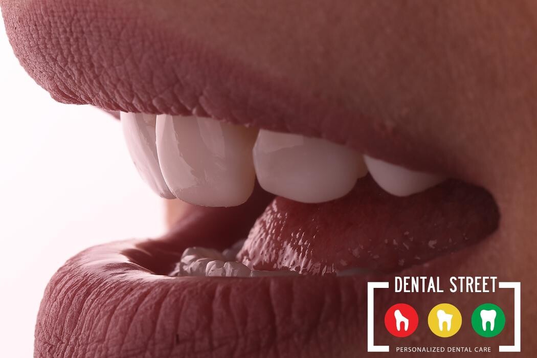 Images Dental Street