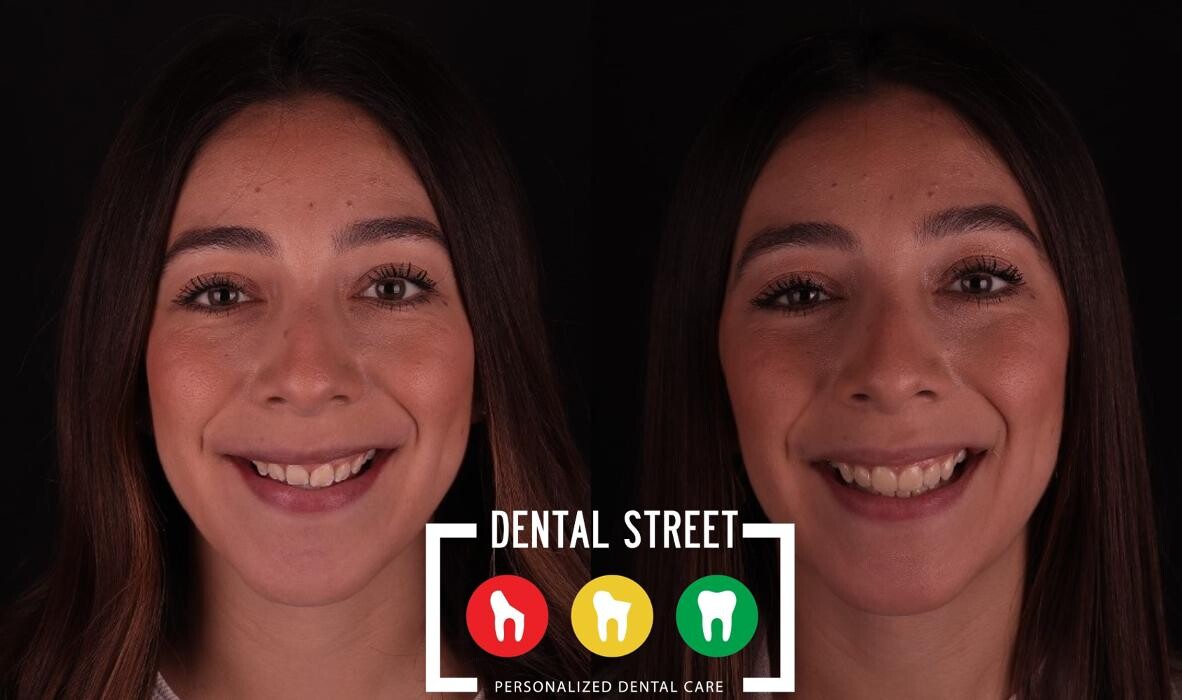 Images Dental Street
