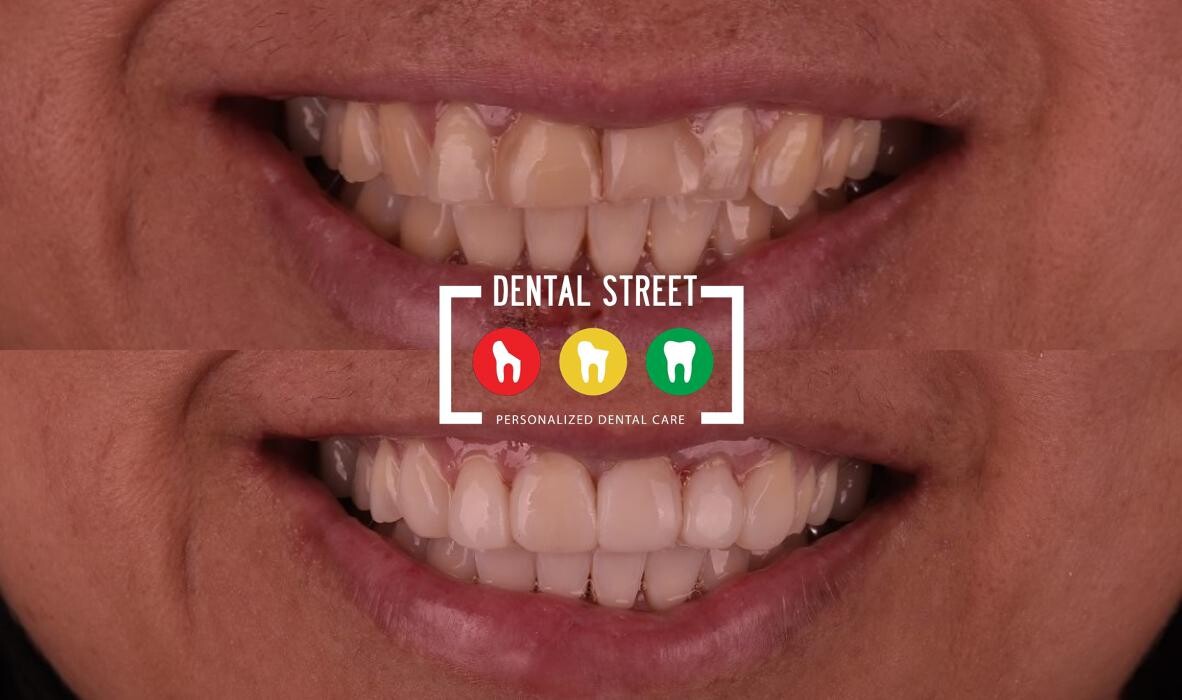 Images Dental Street