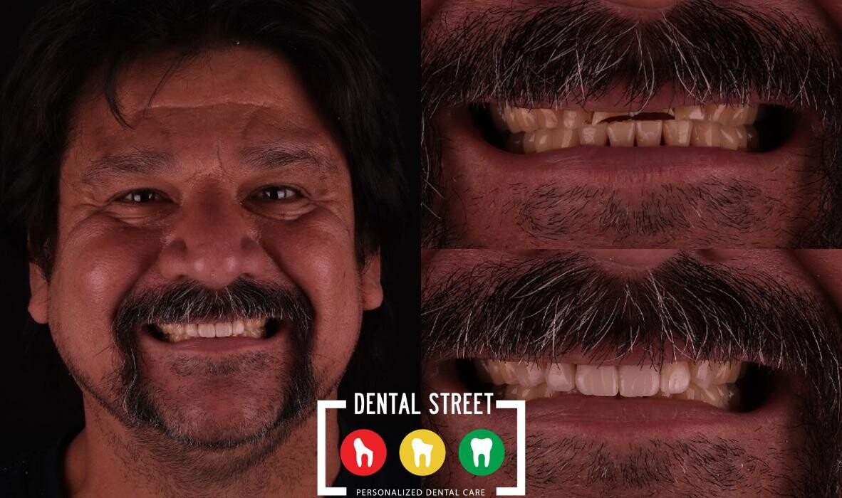 Images Dental Street
