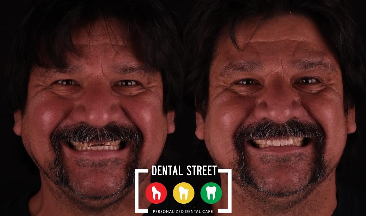 Images Dental Street