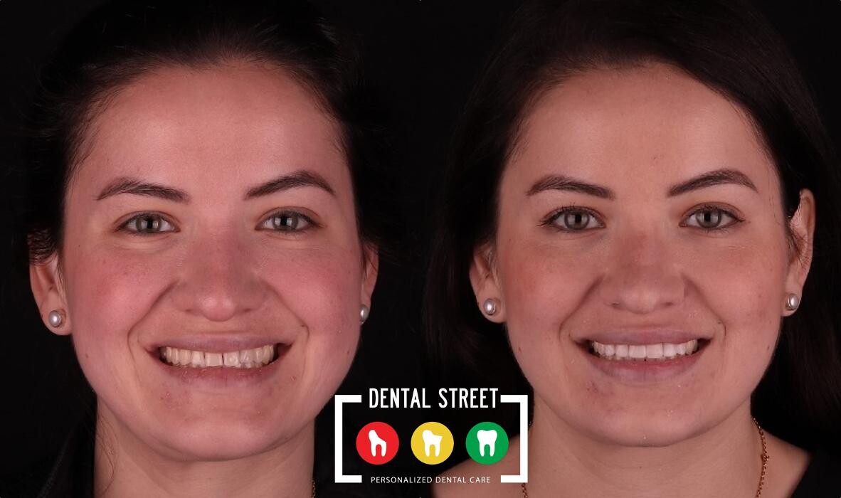 Images Dental Street