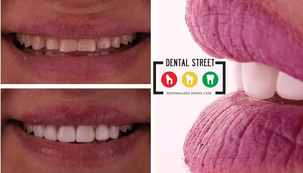 Images Dental Street