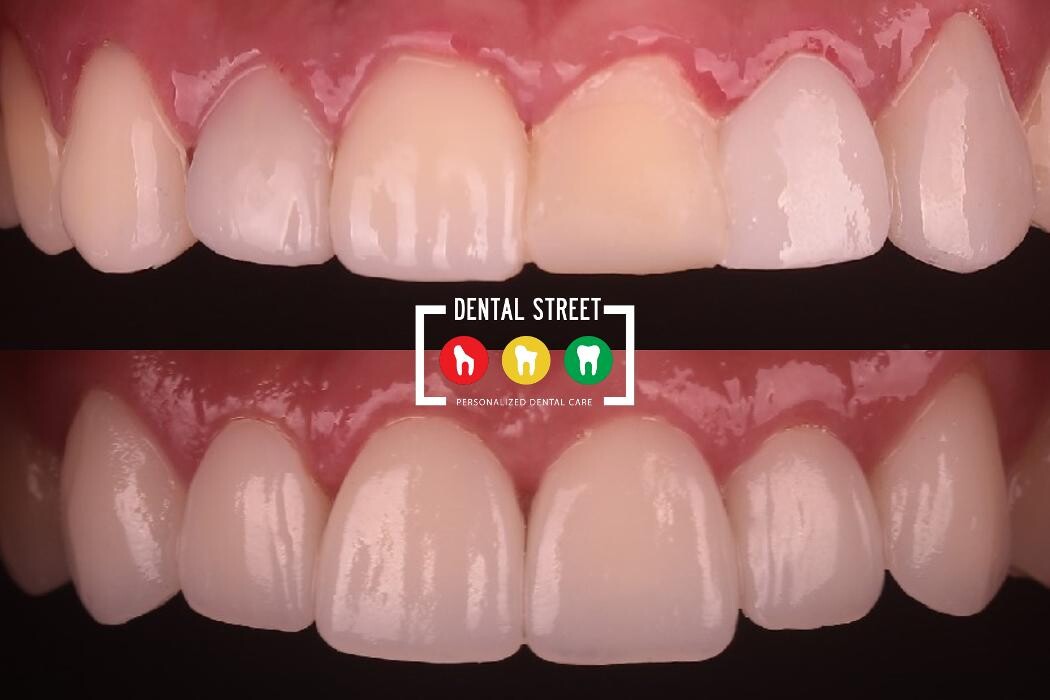 Images Dental Street