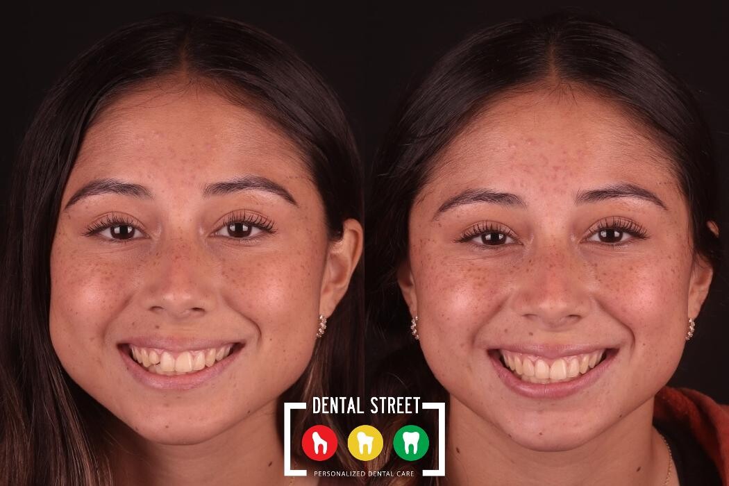 Images Dental Street