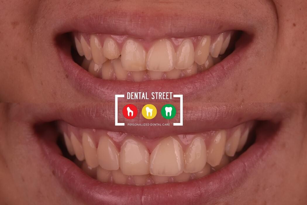Images Dental Street