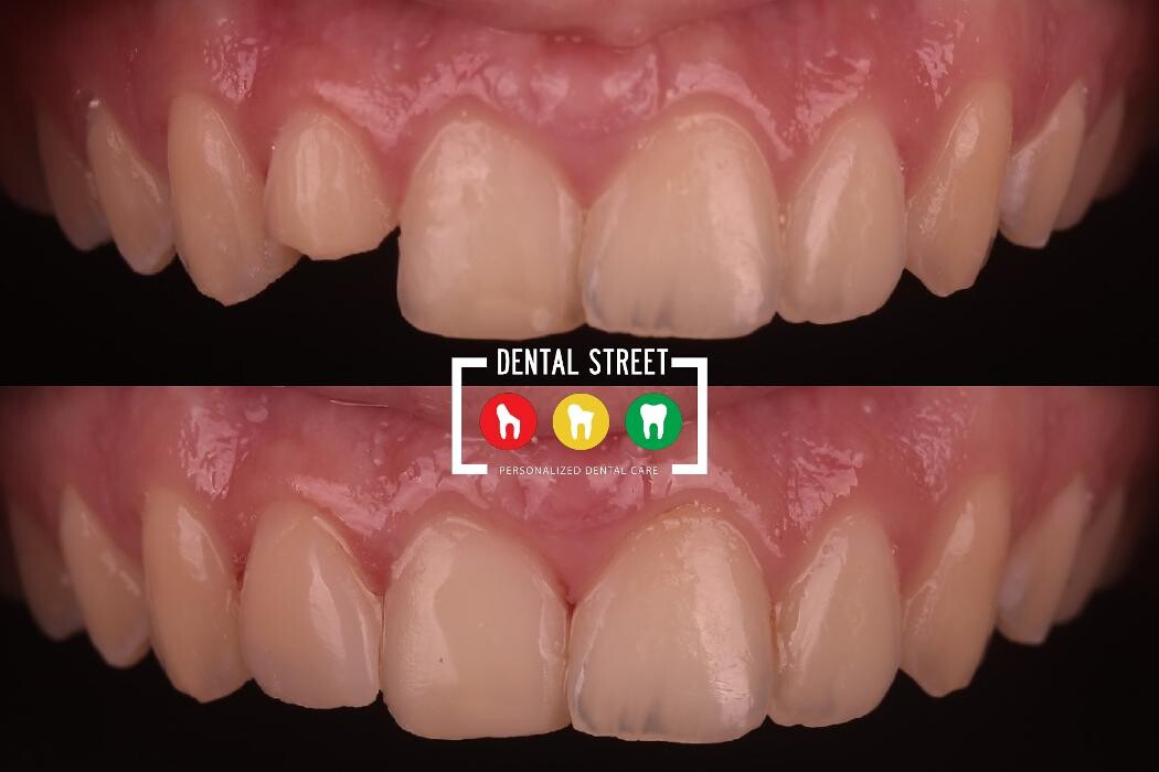 Images Dental Street