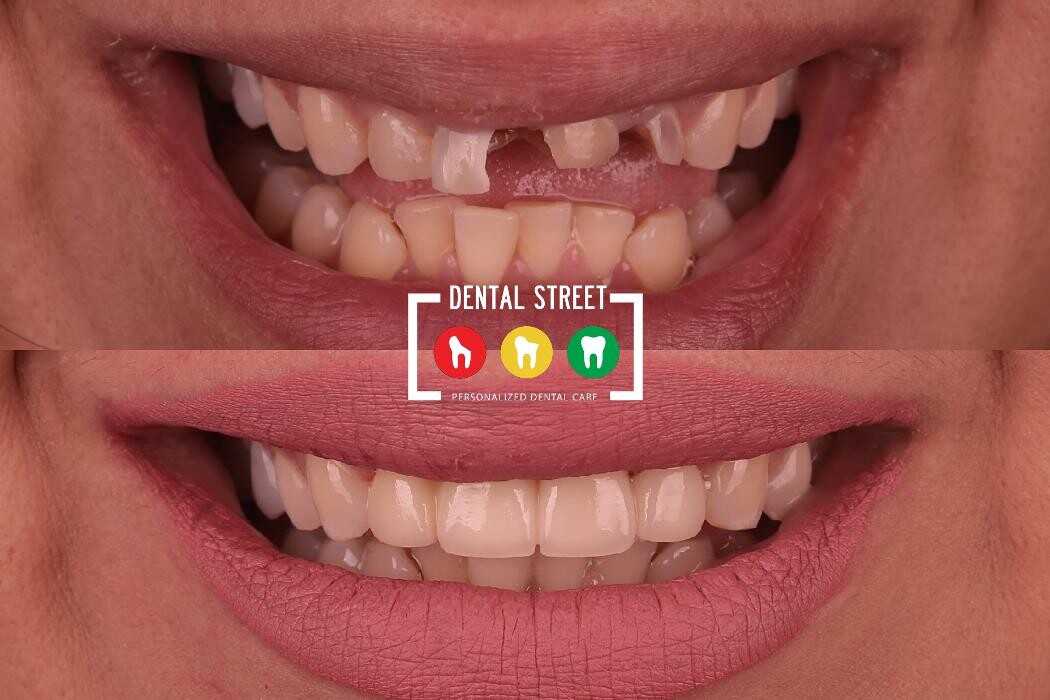 Images Dental Street