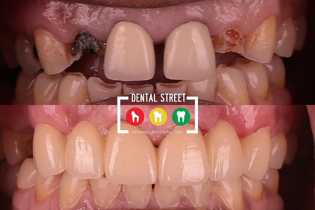 Images Dental Street
