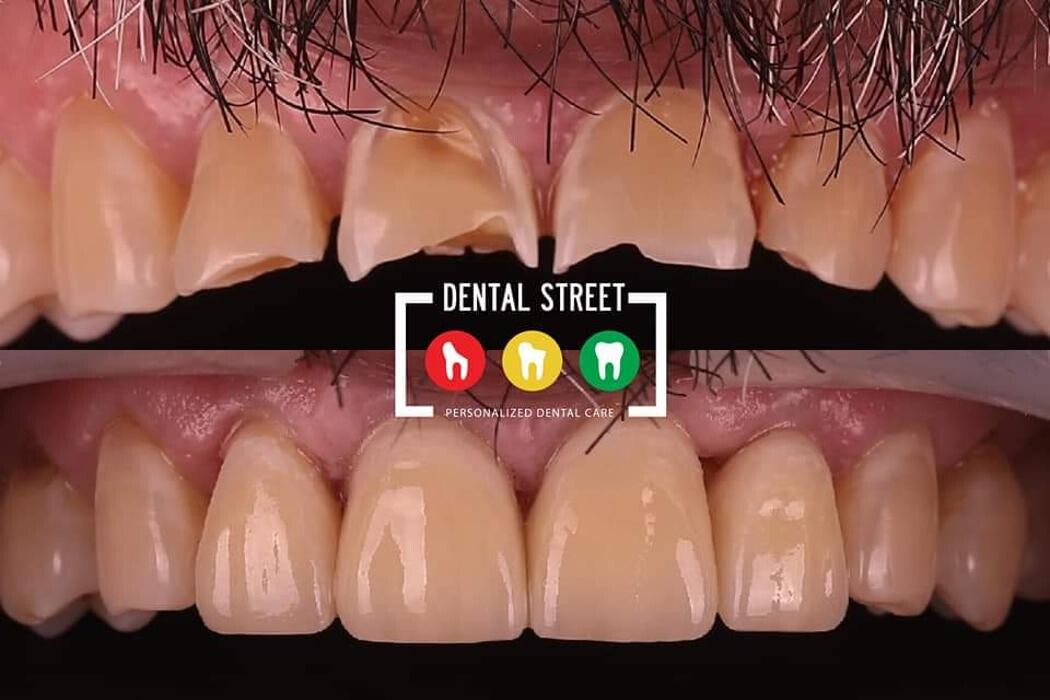 Images Dental Street