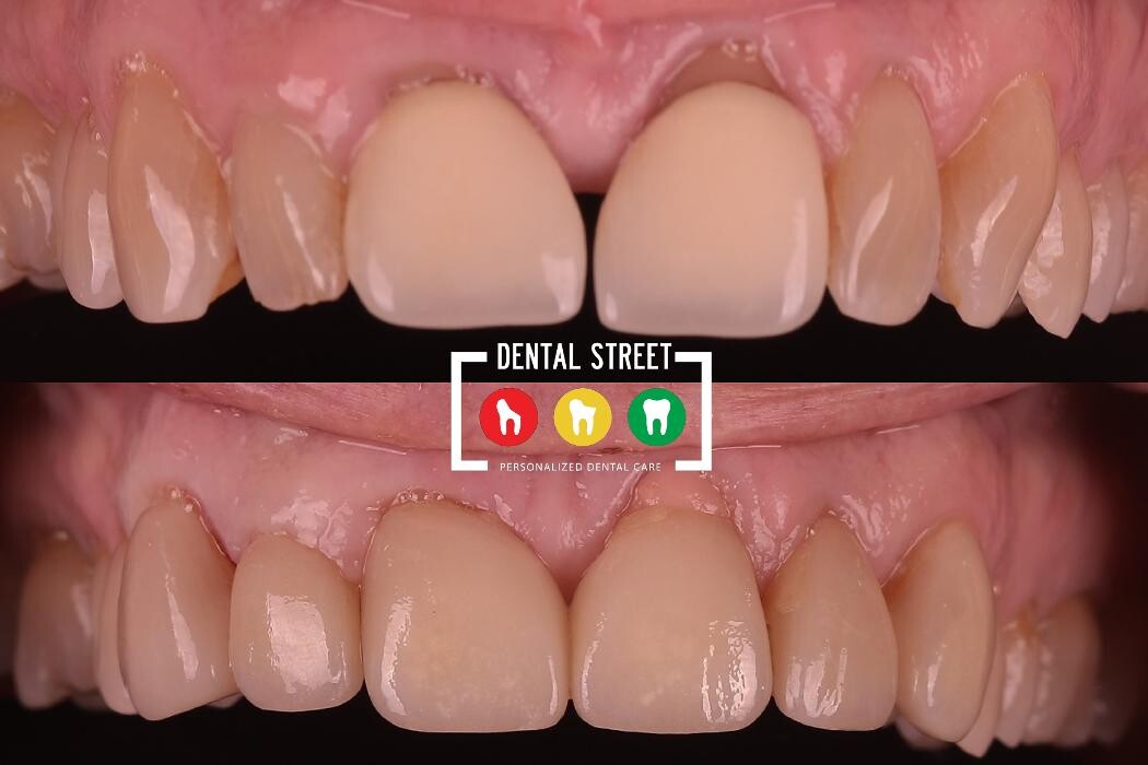 Images Dental Street