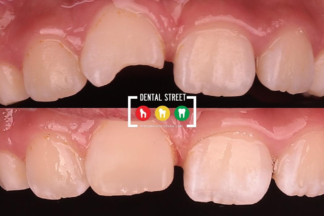 Images Dental Street