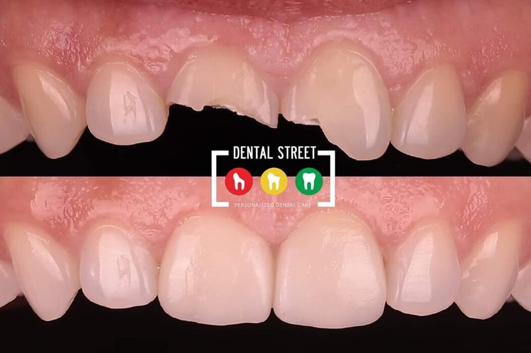 Images Dental Street