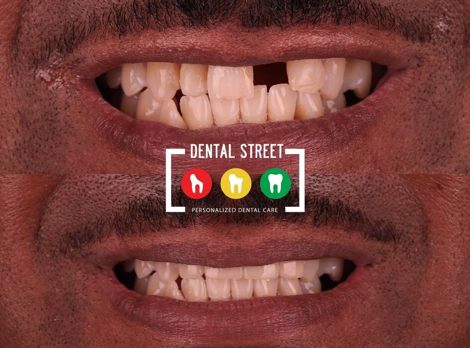 Images Dental Street