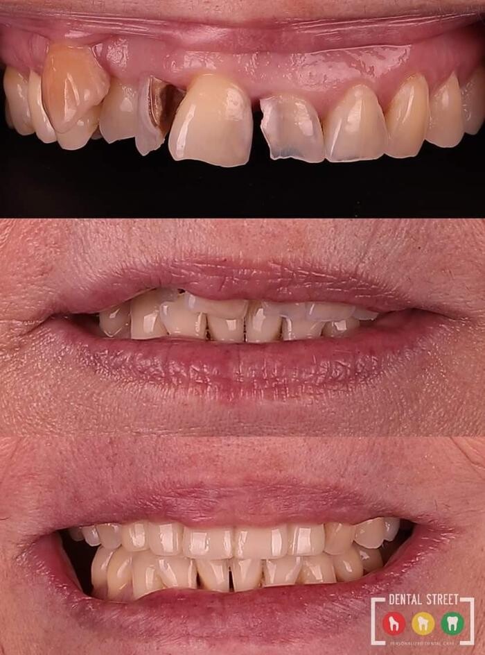 Images Dental Street