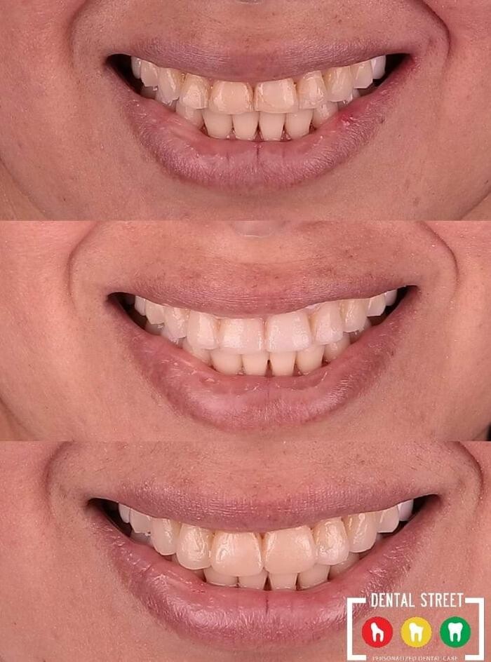 Images Dental Street