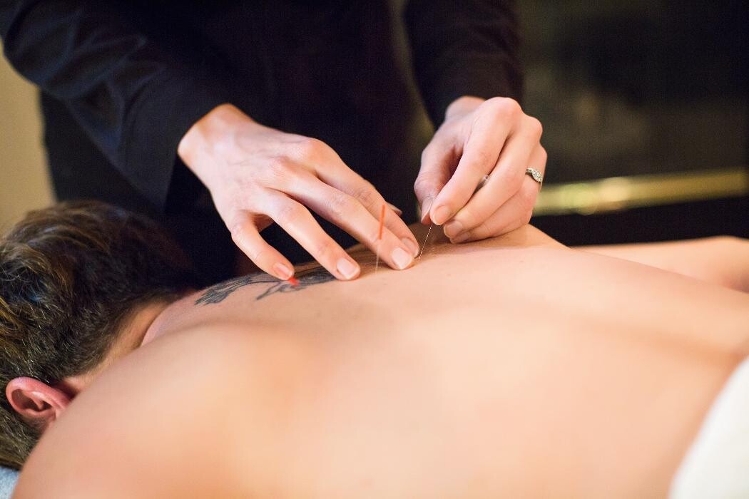 Images Maryville Acupuncture
