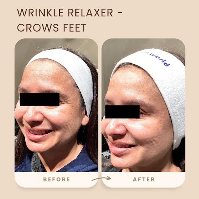 Images Revitalize Beauty Medspa