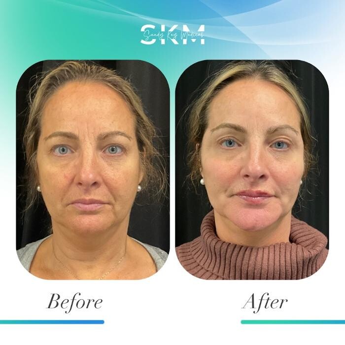 Images Sandy Key Medical