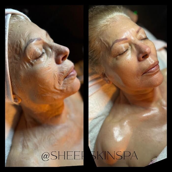 Images Sheer Skin Spa