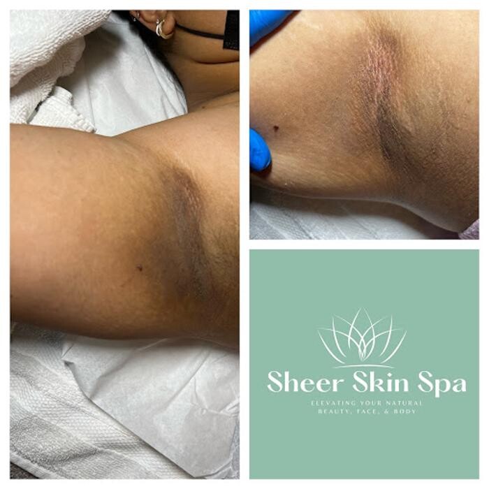 Images Sheer Skin Spa