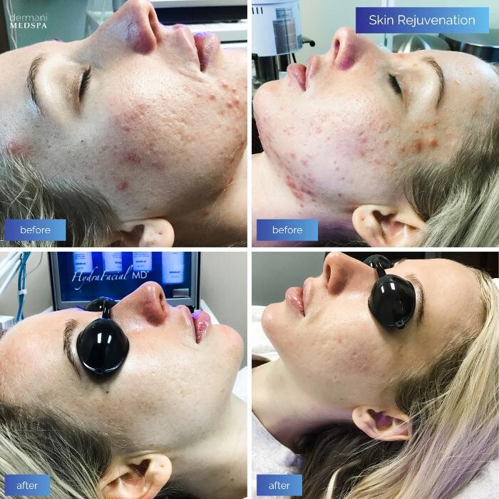 Images dermani MEDSPA