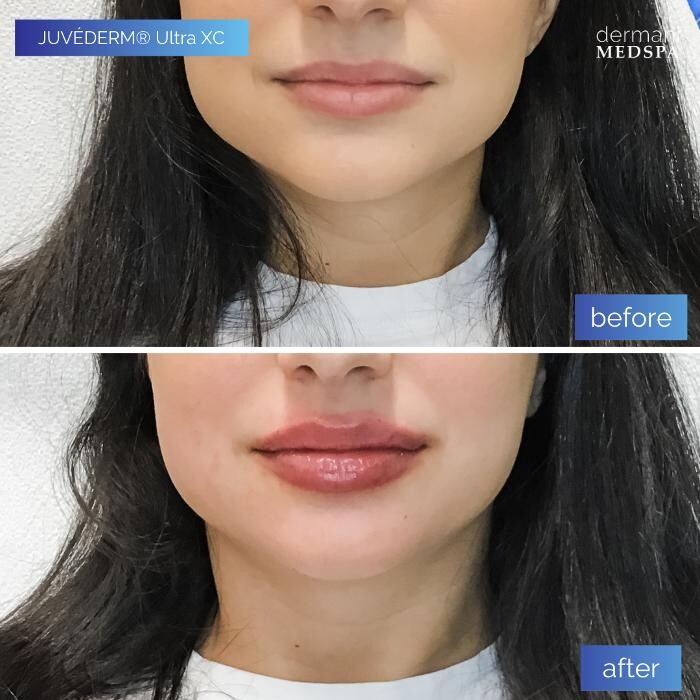 Images dermani MEDSPA