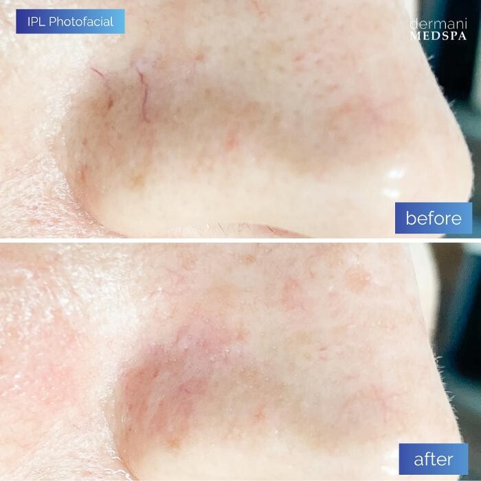 Images dermani MEDSPA