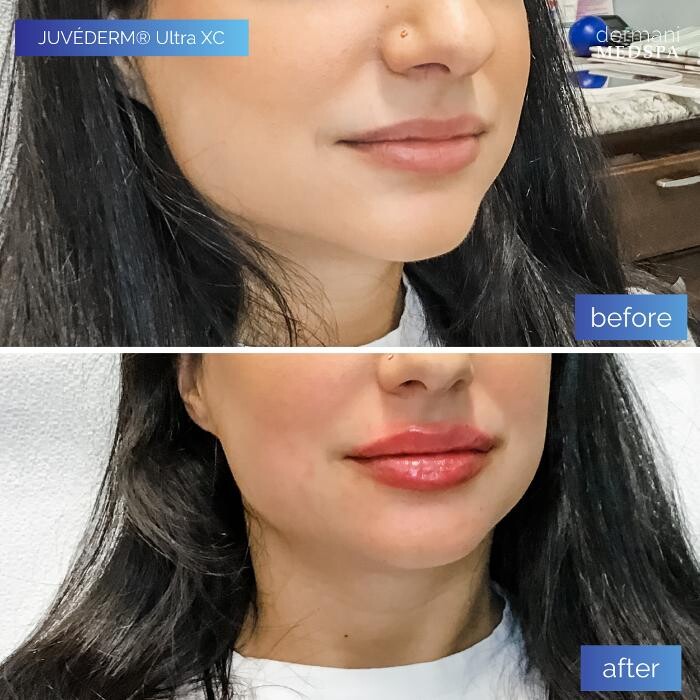 Images dermani MEDSPA