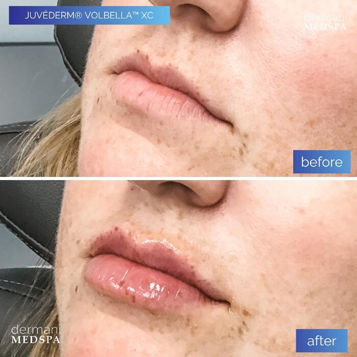 Images dermani MEDSPA