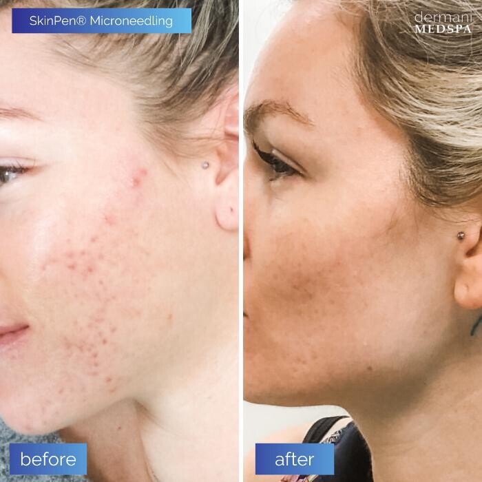 Images dermani MEDSPA