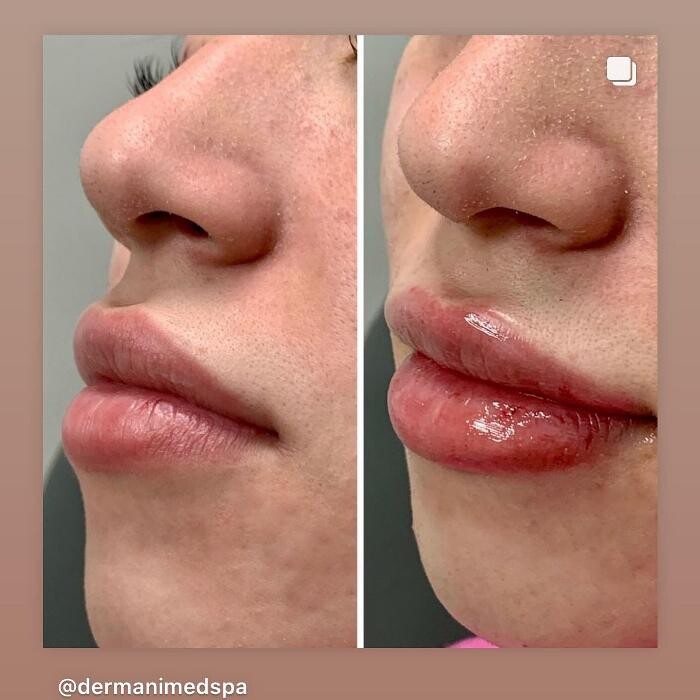 Images dermani MEDSPA Duluth