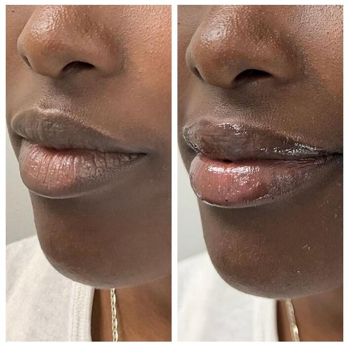 Images dermani MEDSPA Duluth