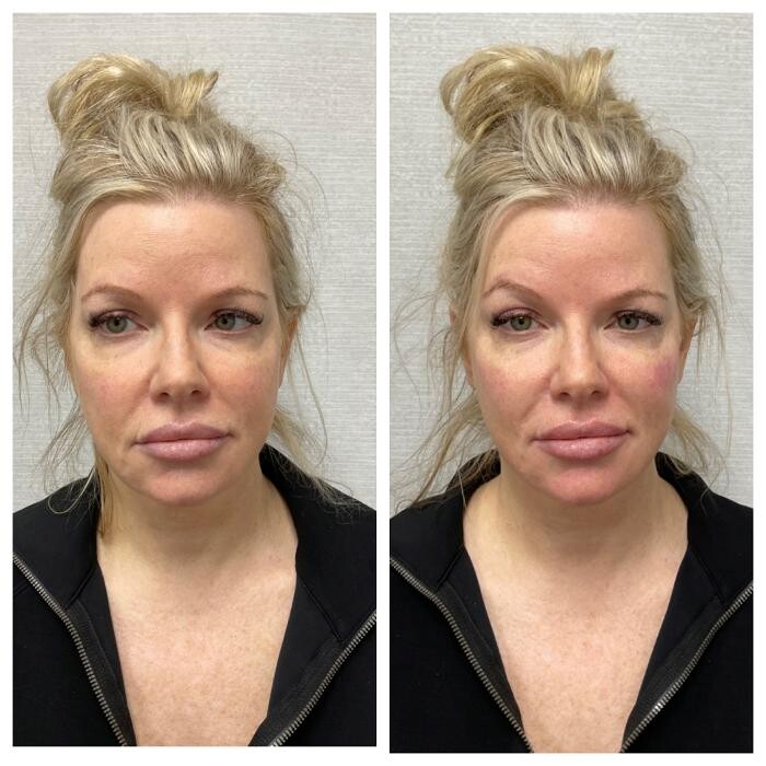 Images dermani MEDSPA Duluth