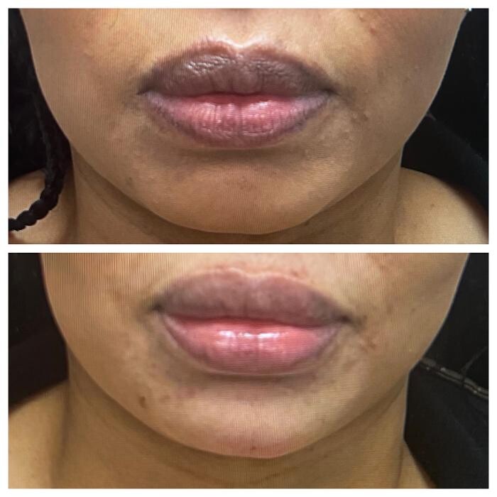 Images dermani MEDSPA Duluth