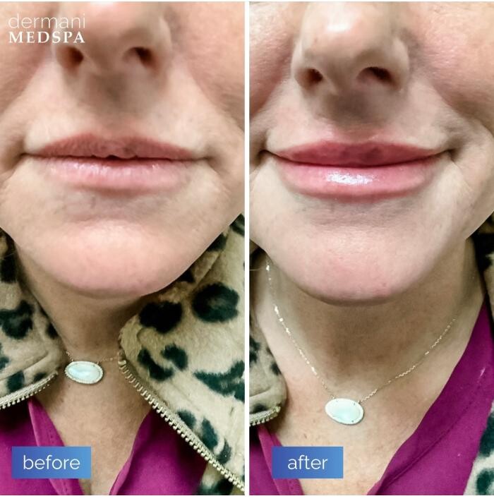 Images dermani MEDSPA Duluth