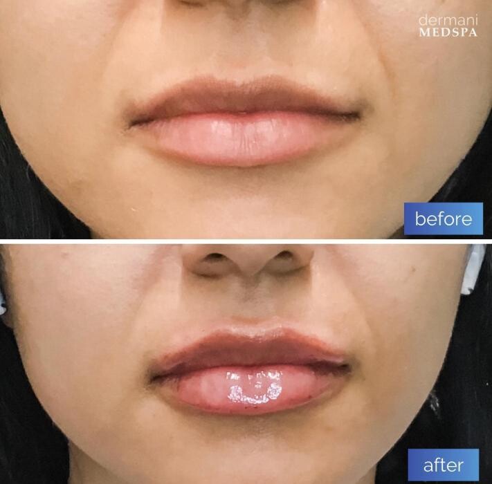 Images dermani MEDSPA Duluth