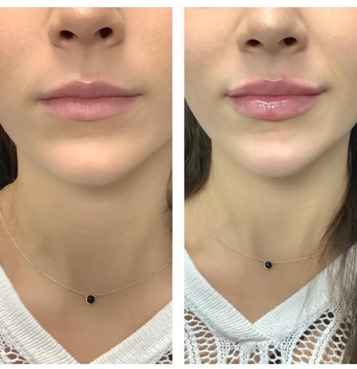 Images dermani MEDSPA Duluth