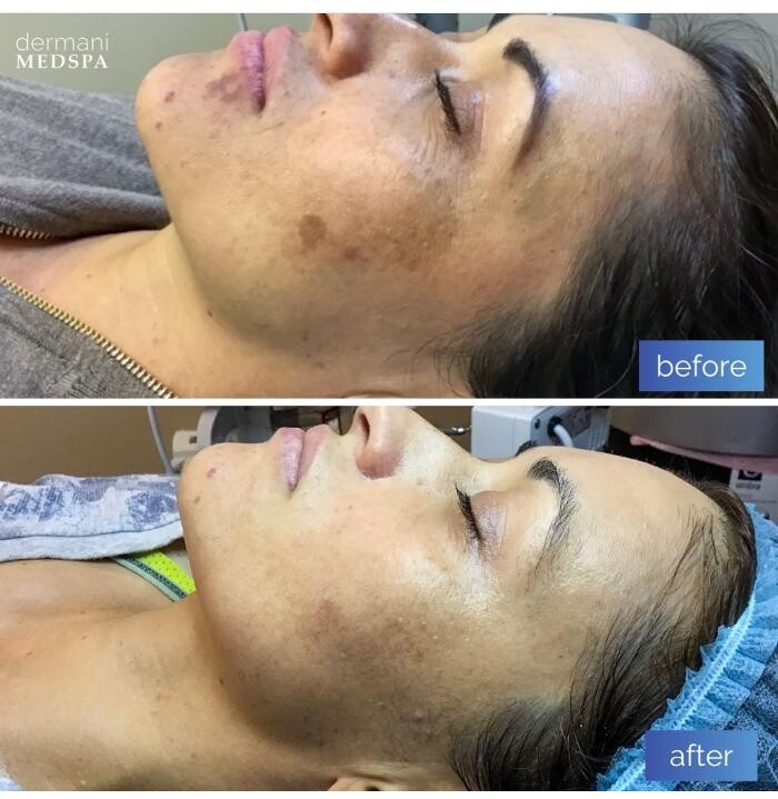 Images dermani MEDSPA Duluth