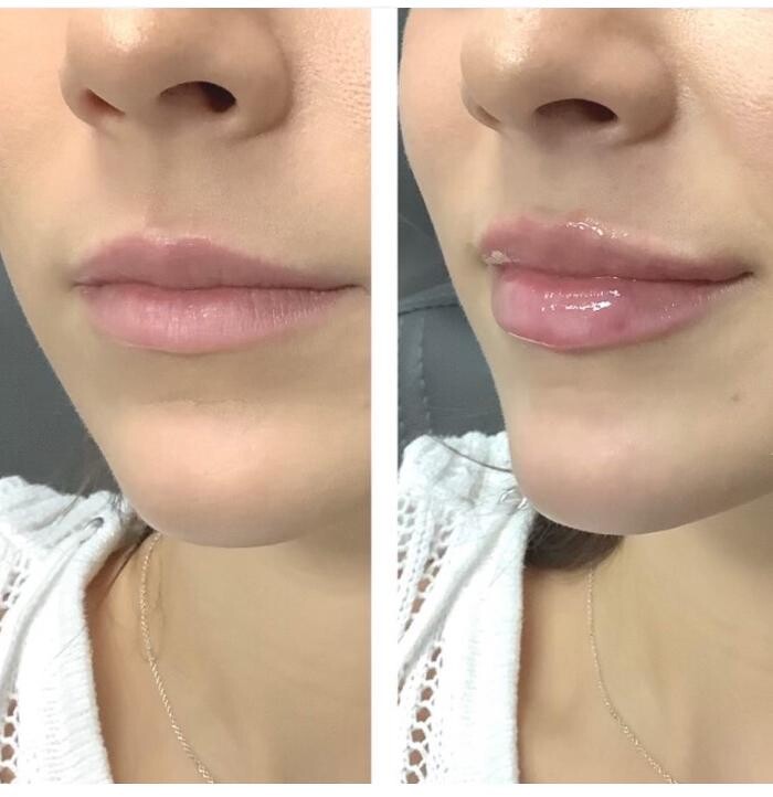 Images dermani MEDSPA Duluth