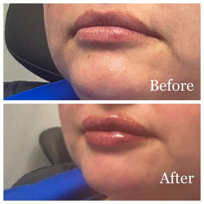 Images dermani MEDSPA Duluth