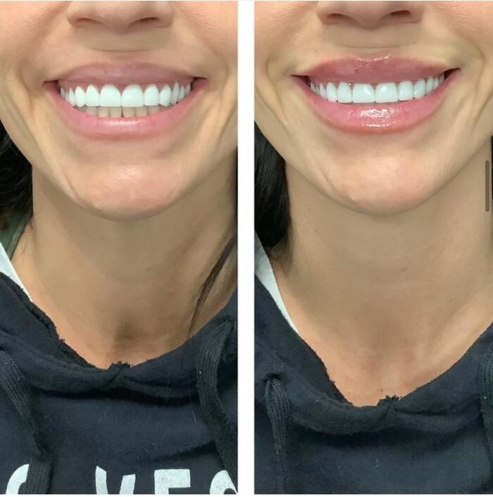 Images dermani MEDSPA Duluth