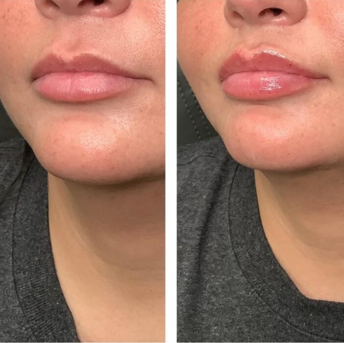 Images dermani MEDSPA Duluth