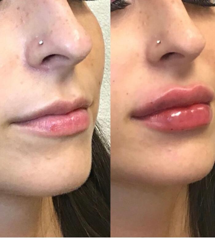 Images dermani MEDSPA Duluth