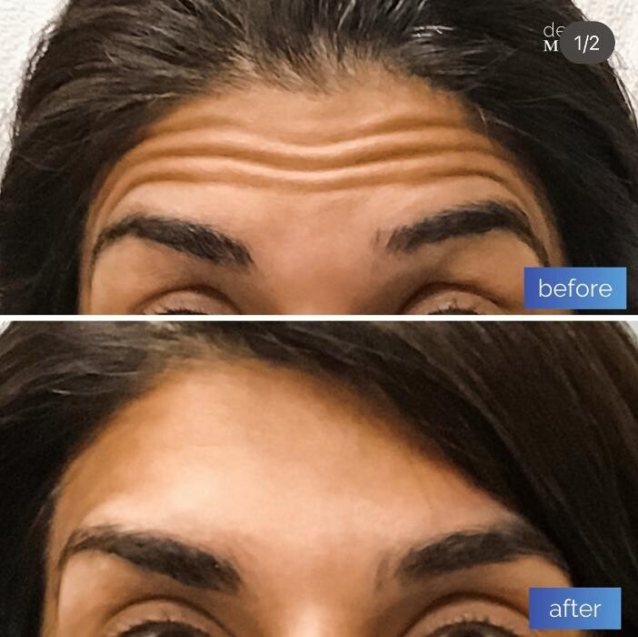 Images dermani MEDSPA Duluth