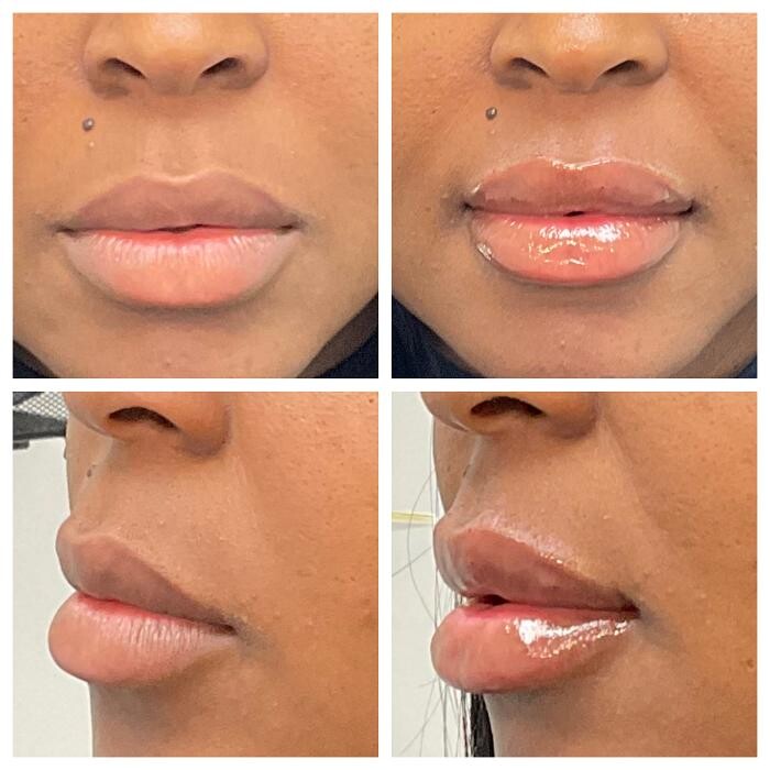 Images dermani MEDSPA Duluth