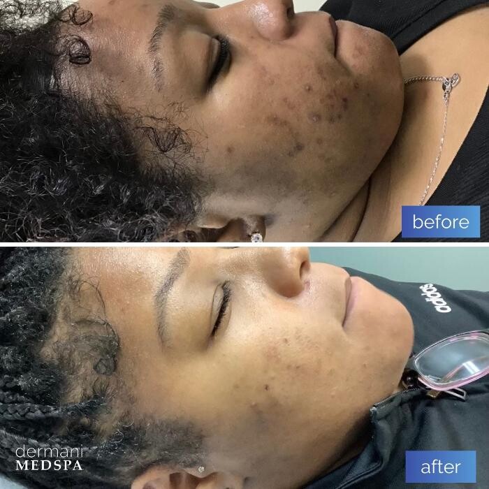 Images dermani MEDSPA Duluth