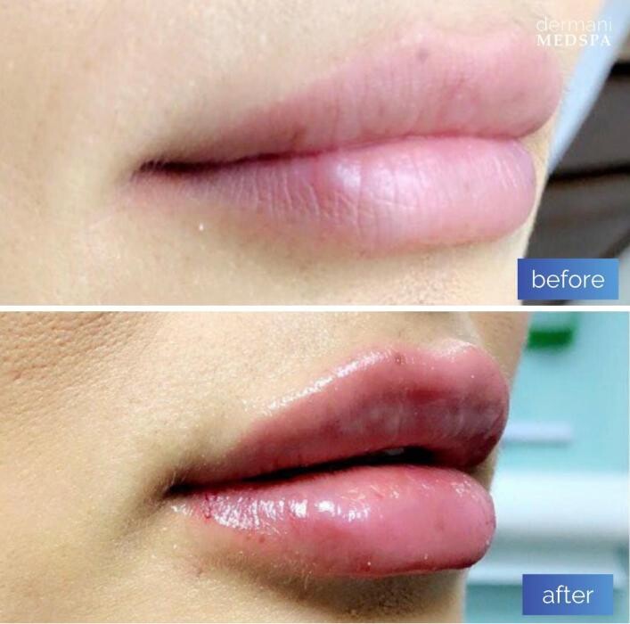 Images dermani MEDSPA Duluth