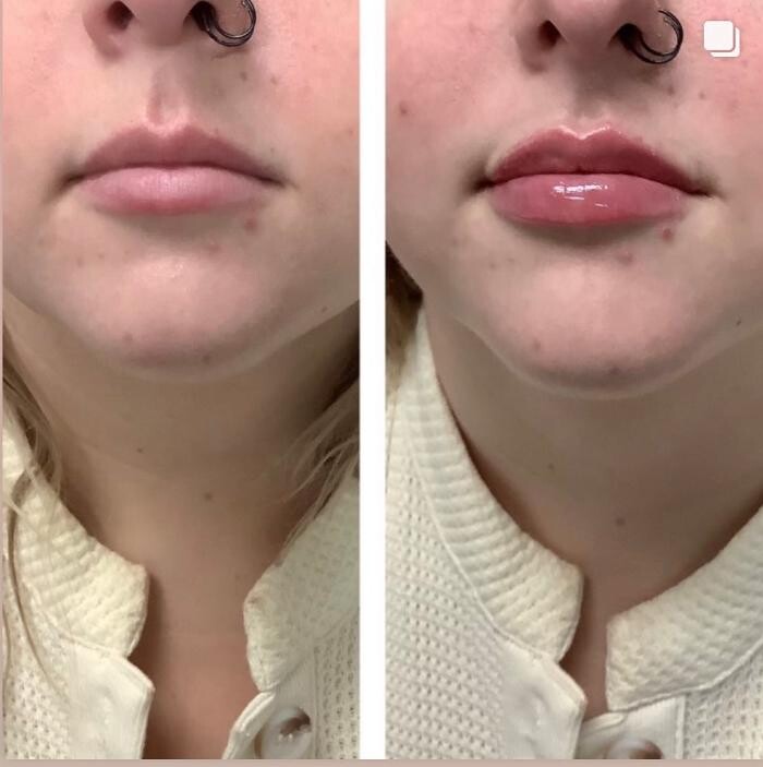 Images dermani MEDSPA Duluth