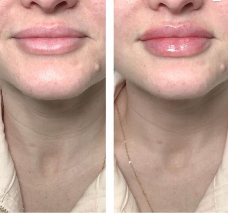 Images dermani MEDSPA Duluth